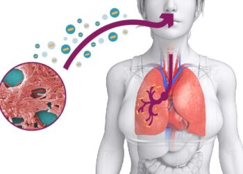 Brote de Legionella en NYC: declaran emergencia y llaman a consultar médico