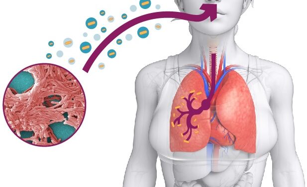 Brote de Legionella en NYC: declaran emergencia y llaman a consultar médico