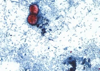 Funcionarios estadounidenses vinculan brote de ciclospora que afecta lechuga iceberg con otros 3 estados