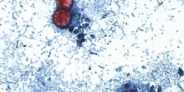 Funcionarios estadounidenses vinculan brote de ciclospora que afecta lechuga iceberg con otros 3 estados