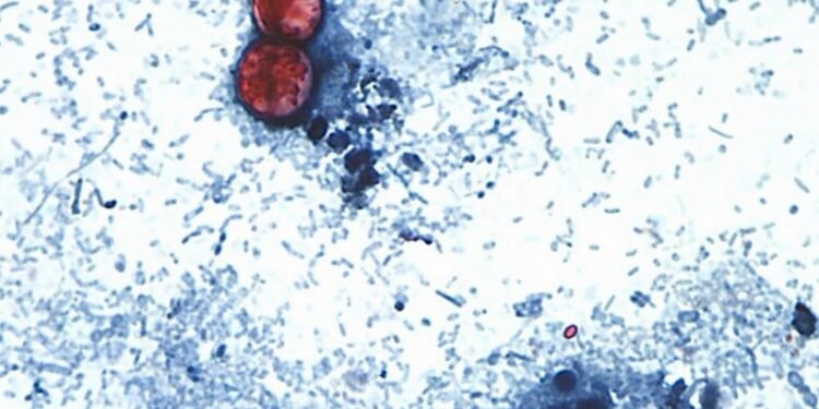 Funcionarios estadounidenses vinculan brote de ciclospora que afecta lechuga iceberg con otros 3 estados