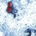 Funcionarios estadounidenses vinculan brote de ciclospora que afecta lechuga iceberg con otros 3 estados