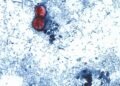 Cyclospora