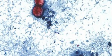 Cyclospora